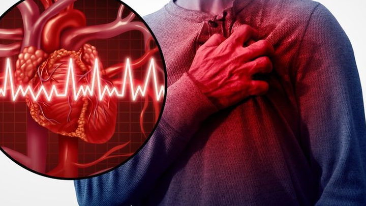 PCI Complex menjadi alternatif penanganan sumbatan pembuluh darah jantung