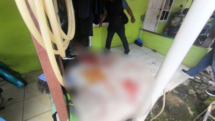 Pergelangan Tangan Siti Hilang karena Amarah Sang Mantan, Kini Dia Jalani Operasi